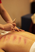 Foot Reflexology